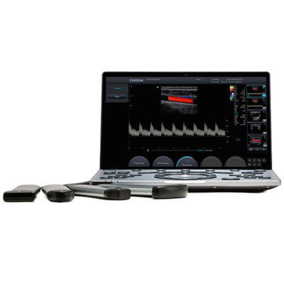Ultrazvukový diagnostický systém SonoAir 60 - 1